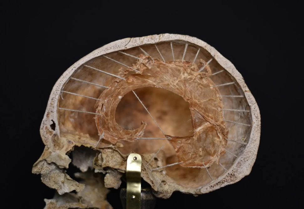 Anatomical Preservations