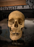 Deformed Antique Medical Skull