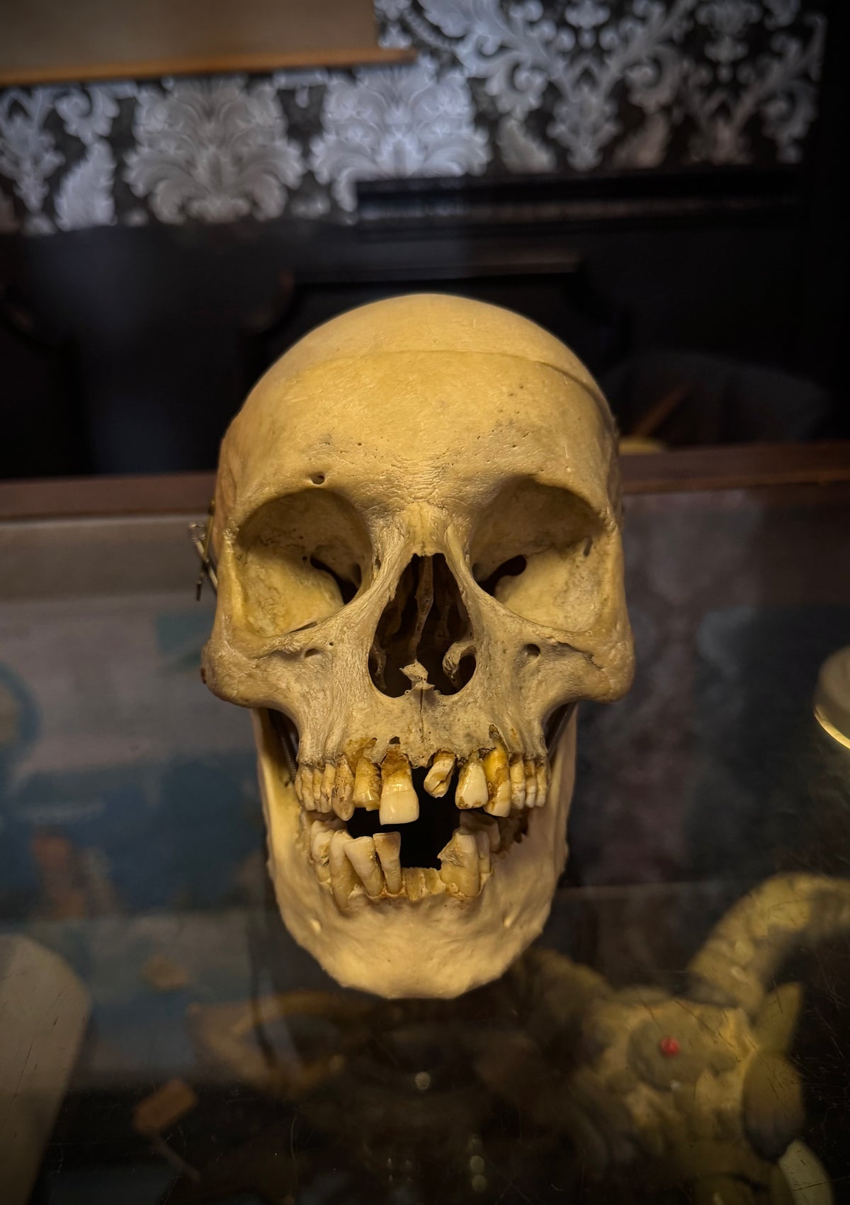 Adult Male 1800s Medical Skull